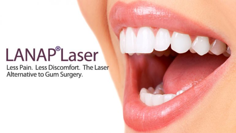 Θεραπεία Περιοδοντικής Νόσου με Laser