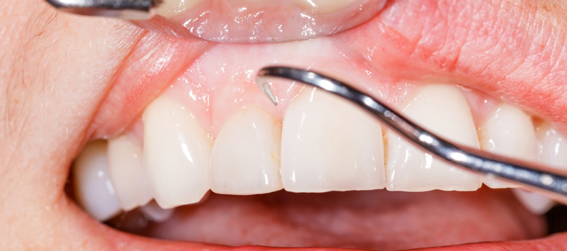 <div>Περιοδοντολογία</div><div><br /></div>