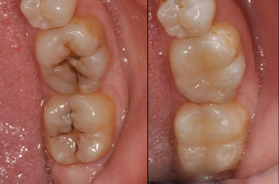 Οδοντική Χειρουργική